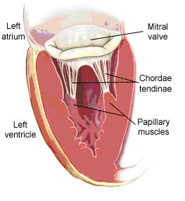 heart_blockage